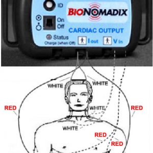 cardiograph analog ecg output signal port