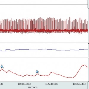 EDA: Electrodermal Activity | Skin Conductance Response Analysis ...