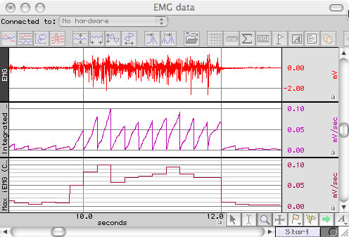 Root Mean Square (RMS) EMG Data